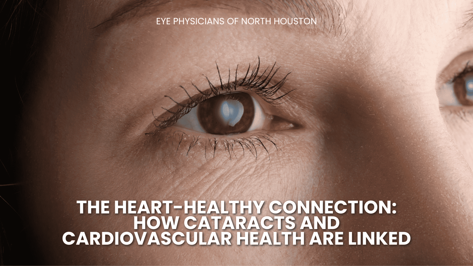The Heart-Healthy Connection: How Cataracts and Cardiovascular Health Are Linked
